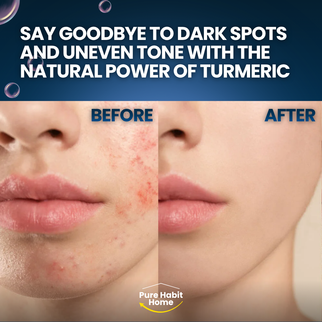 100G Turmeric Hand Made Soap, Lemon Kojic Acid Soap, Shower and Facial Soap Deep Cleaning for Face Body Skin Care