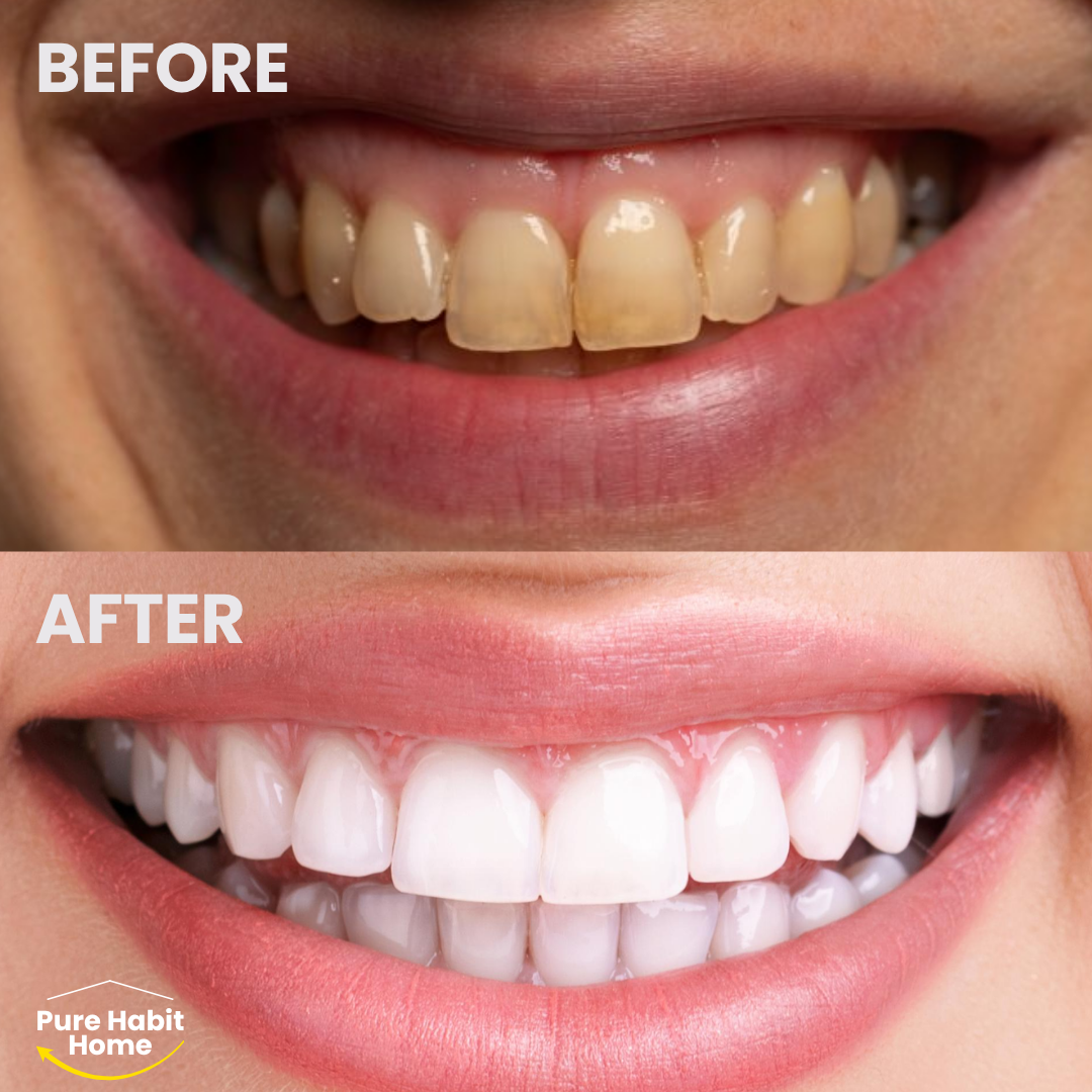 Water Flossers for Teeth Dental Oral Irrigator Cordless Rechargeable for Braces for Travel Teeth Cleaning 5 Cleaning Modes